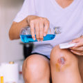 Signs of an Infected Cut: What an Infected Cut Looks Like & How to Prevent Worsening Symptoms