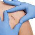 Are These Infected Stitches Pictures Normal? Signs & Care Guide