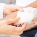 How to Treat Wounds That Won’t Heal Naturally and Medically for Faster Healing