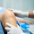How Long Do Dissolvable Stitches Last? Healing Facts You Need to Know