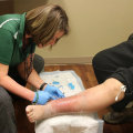 Excoriation Wound Care: Causes, Symptoms, and Expert-Recommended Treatment for Faster Healing