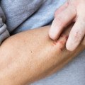 The Nighttime Healing Guide: How to Heal Cuts Faster Overnight