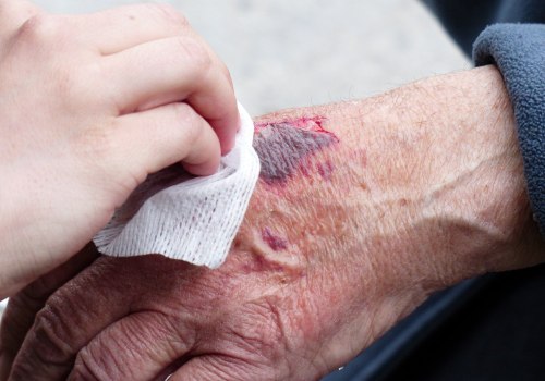 The Essential Guide to Wound Care for Caregivers