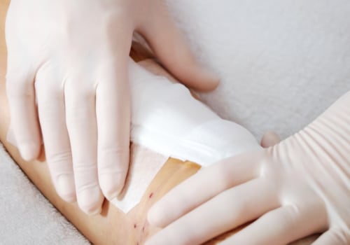 Discover Healing Secrets What Functions Do Clotting and Epithelial Cells Have in the Healing Process