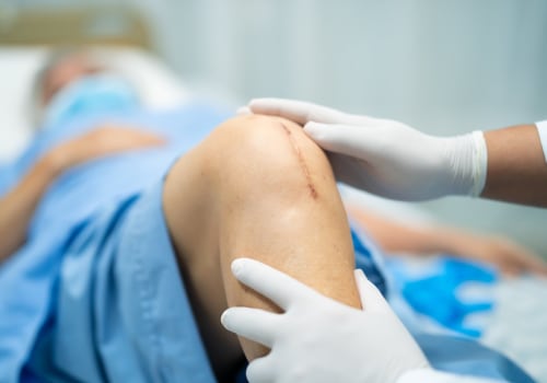 How Long Do Dissolvable Stitches Last? Healing Facts You Need to Know