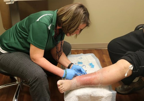 Excoriation Wound Care: Causes, Symptoms, and Expert-Recommended Treatment for Faster Healing