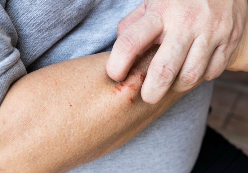 The Nighttime Healing Guide: How to Heal Cuts Faster Overnight
